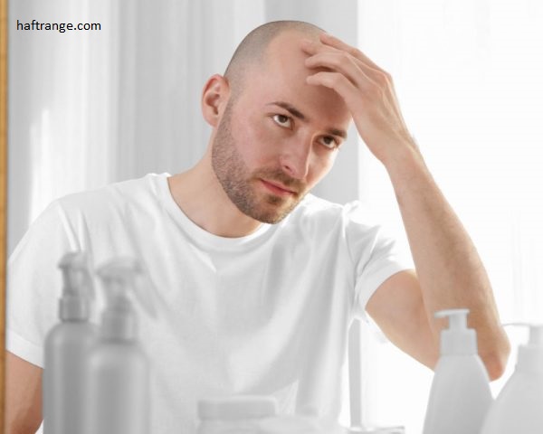 عوامل اصلی ریزش موی آقایان | بررسی عوامل ارثی و محیطی ریزش مو